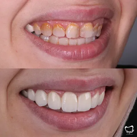 مركز طيبة لطب الفم والأسنان